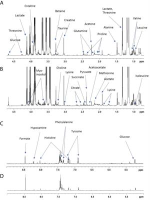 Prebiotic Supplementation During Pregnancy Modifies the Gut Microbiota and Increases Metabolites in Amniotic Fluid, Driving a Tolerogenic Environment In Utero